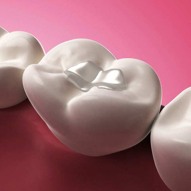 Cosmetic Dentistry in Toronto's High Park Area